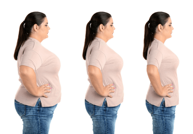 Obese Women Transformation Depo
