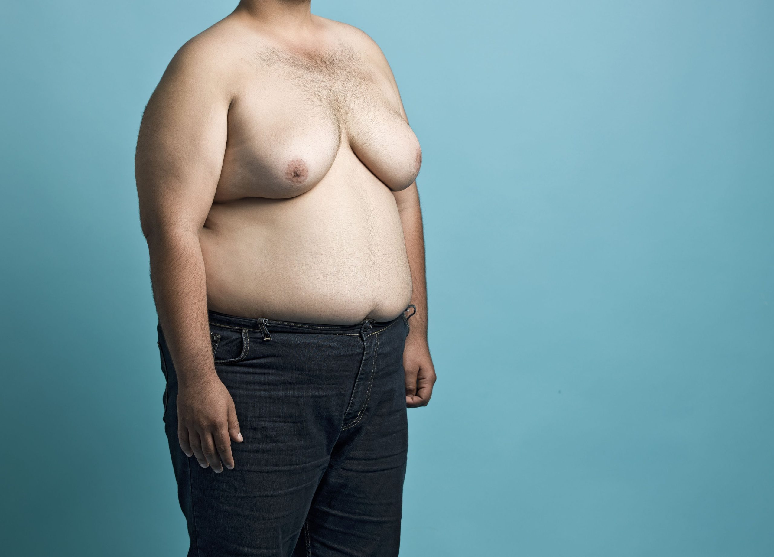 Obese Young Man Royalty Free Image 187045069 1531148344